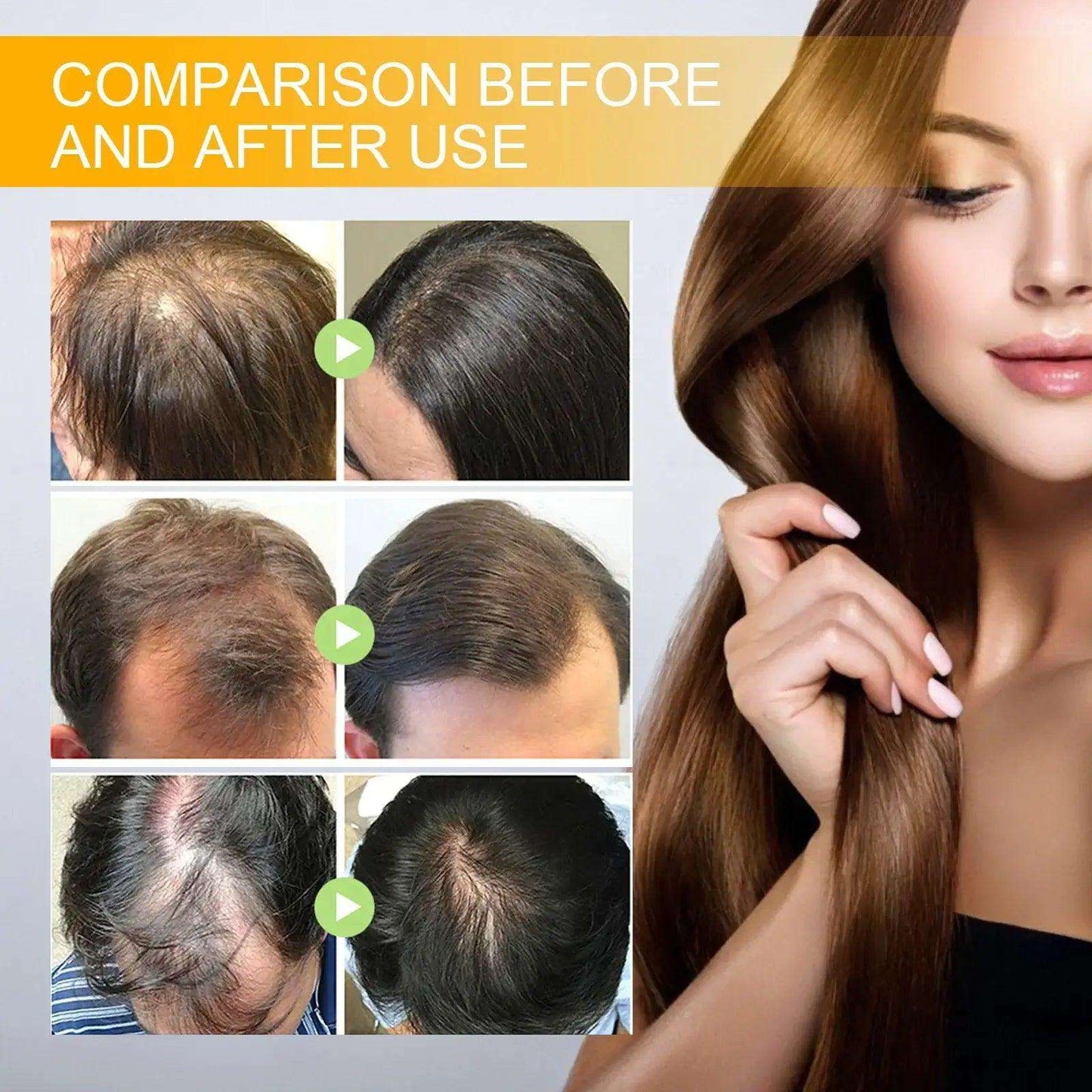 Biotin Fast Hair Growth Products Anti Hair Loss Serum - hairandbeauty