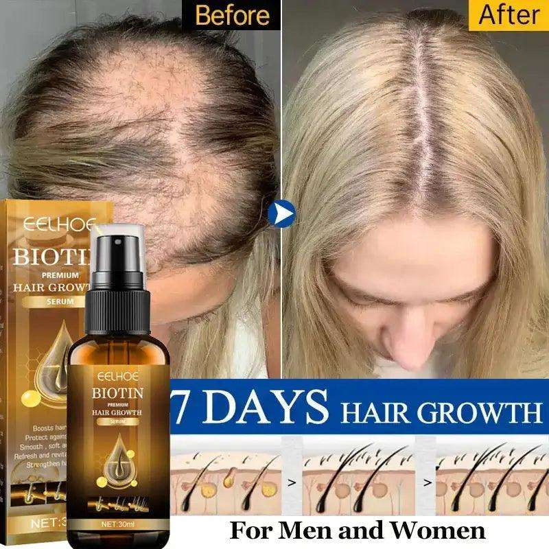 Biotin Fast Hair Growth Products Anti Hair Loss Serum - hairandbeauty