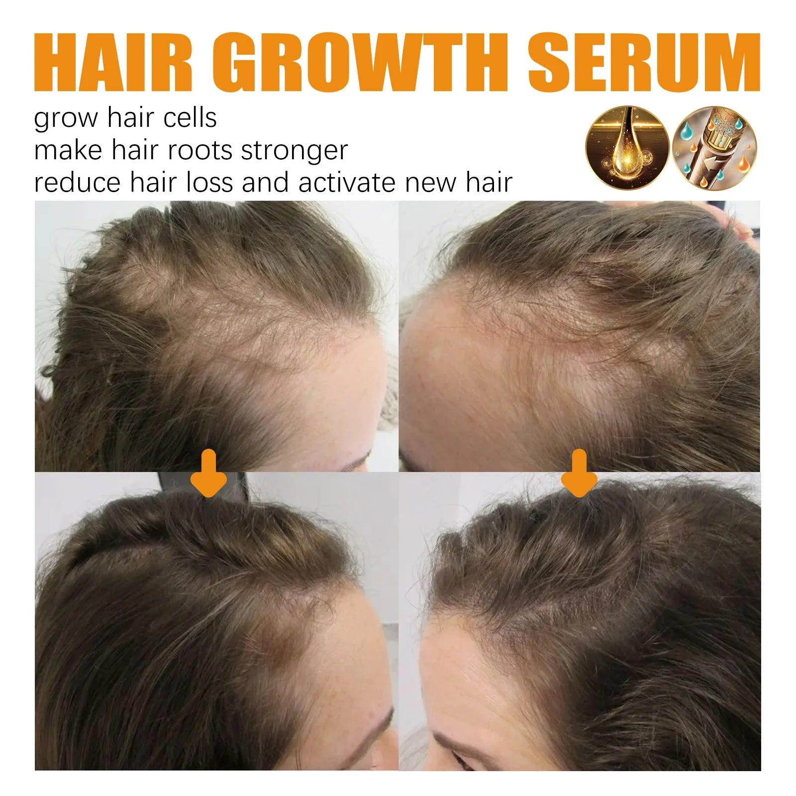 Biotin Hair Growth Spray Anti Dandruff Itching Treatment - hairandbeauty